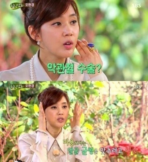 오현경(탤런트/미스코리아)
배우 오현경이 보톡스 마니아라는 루머에 대해 재활 목적으로 맞는다는 해명을 해 화제다.
[사진출처=SBS ‘힐링캠프-기쁘지 아니한가’캡처]