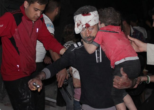 A wounded Syrian man carries a child after shelling on the Bustan al-Qasr district of the northern Syrian city of Aleppo on Wednesday.   AFP-Yonhap