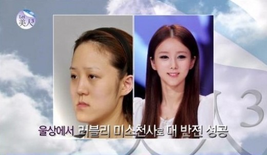 ▲렛미인 방미정 (사진=렛미인3 방송캡처)