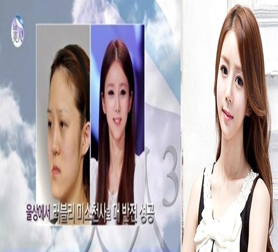 ▲렛미인 방미정 (사진=렛미인 방송캡처/ 스토리온)