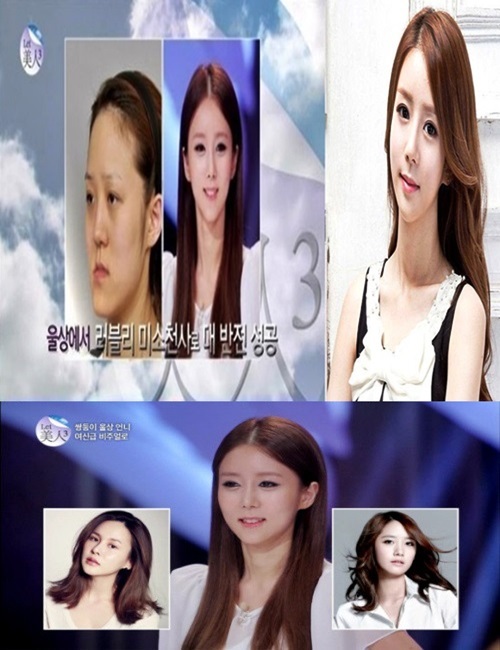 ▲렛미인 방미정