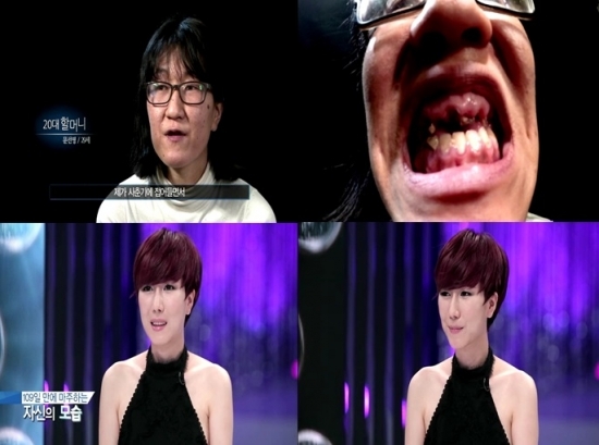 ▲렛미인 동안녀(사진=렛미인 캡처)