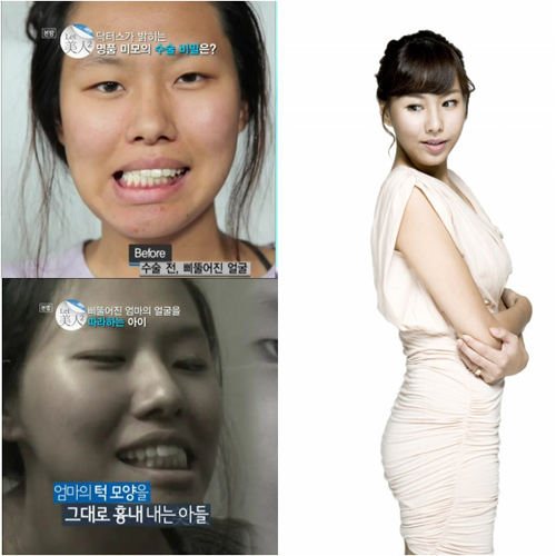 ▲ 렛미인 삐뚤어진 엄마