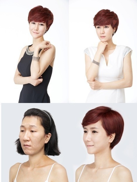 ▲ 렛미인 20대 할머니 노안녀