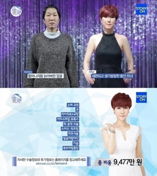 ▲ 렛미인4 20대 할머니 노안녀 문선영