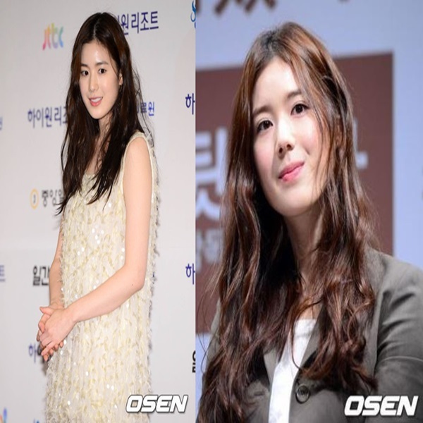 ▲정은채 (사진=OSEN)