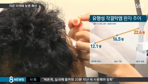 ▲유행성 눈병 주의(사진=SBS)