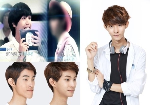 ▲렛미인4 렛미남 양정현 주걱턱남 엠블랙 미르 (사진=스토리온 제공)