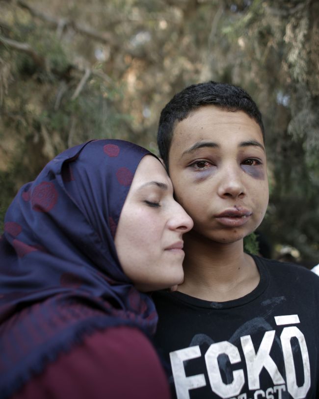 Tariq Abu Khder (right), a Palestinian-U.S. teenager who was allegedly beaten during police custody, is hugged by his mother following a hearing at Jerusalem Magistrates Court on Sunday. AFP-Yonhap