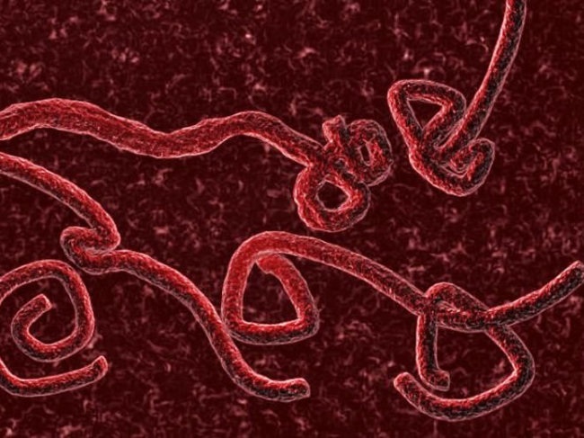 '에볼라 바이러스' 환자 미국 송환…영화 '아웃브레이크' 현실화 될까 ...