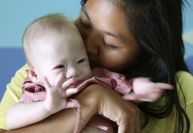 <YONHAP PHOTO-0887> Pattaramon Chanbua, right, kisses her baby boy Gammy at a hospital in Chonburi province, southeastern Thailand Sunday, Aug. 3, 2014. The Australian government is consulting Thai authorities after news emerged that Gammy, a baby with Downs Syndrome was abandoned with Chanbua, his surrogate mother, in Thailand by his Australian parents, according to local media. (AP Photo/Apichart Weerawong)/2014-08-03 14:11:21/ <저작권자 ⓒ 1980-2014 ㈜연합뉴스. 무단 전재 재배포 금지.>
Pattaramon Chanbua (right) kisses her son Gammy at a hospital in Chonburi province, southeastern Thailand, Sunday.   AP-Yonhap