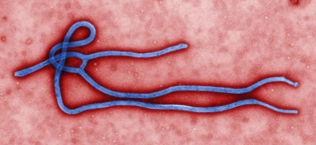 An Ebola virus (AP-Yonhap)
