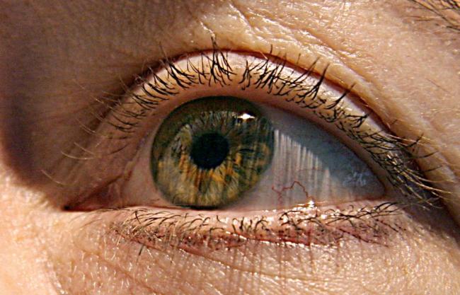 Scientists say they have identified six genetic variants linked to glaucoma.   AFP-Yonhap