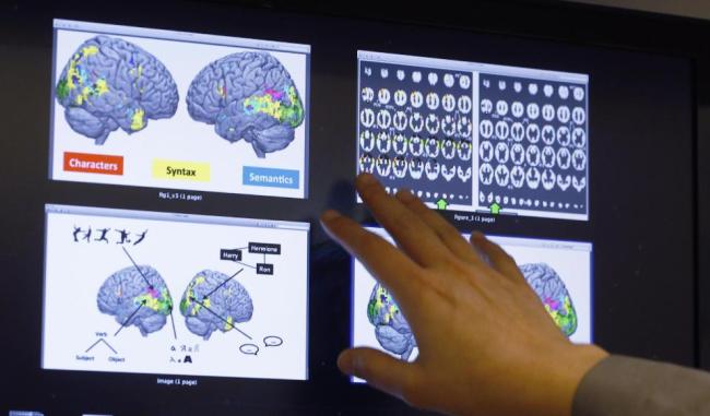 Brain scans from the Harry Potter experiment   AP
