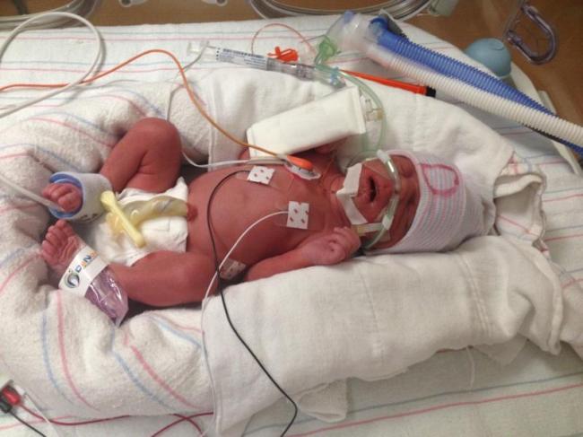 <YONHAP PHOTO-0706> This photo provided by Nicole Todman shows one of quadruplets born prematurely to Erica Morales at a Phoenix hospital on Thursday, Jan. 15, 2015. Morales died hours after giving birth and did not get to hold any of her newborns, according to a family friend. (AP Photo/Courtesy of Nicole Todman)/2015-01-18 09:04:55/ <저작권자 ⓒ 1980-2015 ㈜연합뉴스. 무단 전재 재배포 금지.>
One quadruplet born prematurely to Erica Morales at a Phoenix hospital.   AP-Yonhap