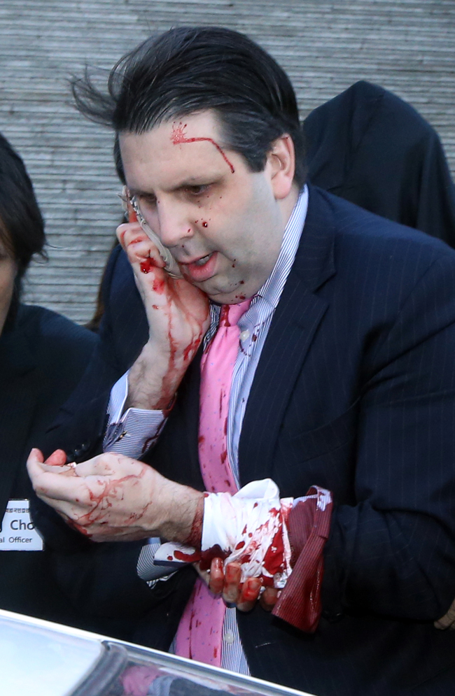 U.S. Ambassador to Korea Mark Lippert hurries into a vehicle while pressing on his wounds after a knife attack at a seminar at the Sejong Center for the Performing Arts in downtown Seoul on Thursday morning. Yonhap