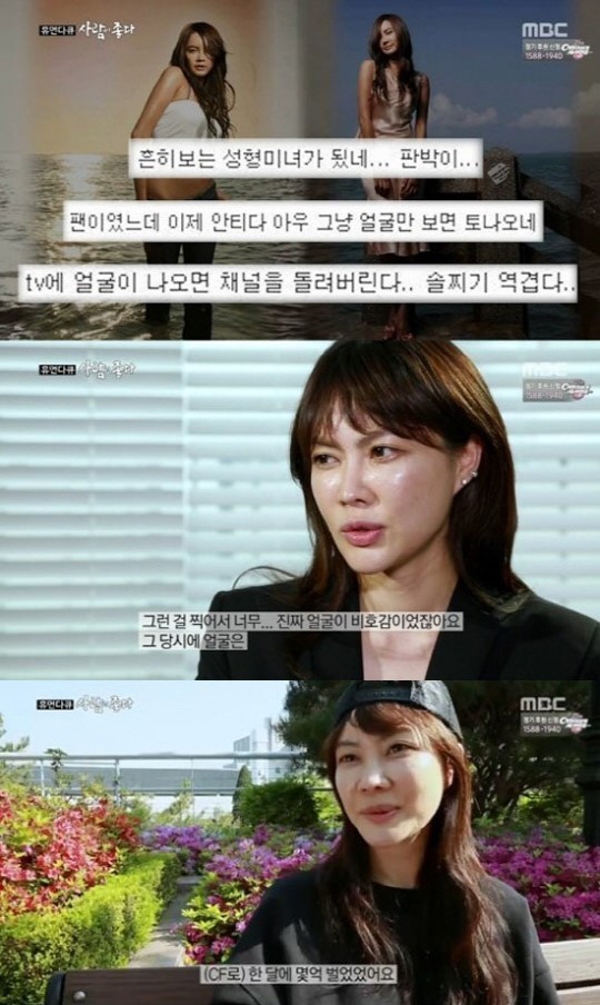 ‘사람이 좋다’ 양미라 “괴물로 변한 얼굴…지금 수입은 0원”
