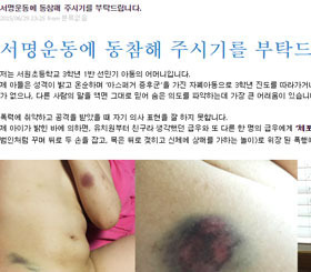 사진=피해자 B군 어머니 블로그