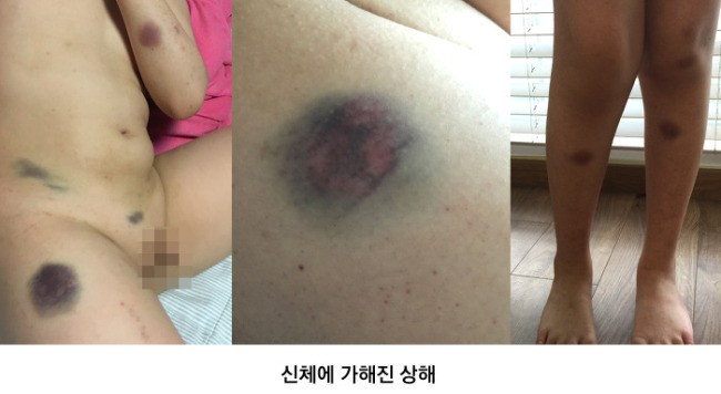 티아라놀이, 체포놀이…놀이빙자 폭력에 멍드는 童心
