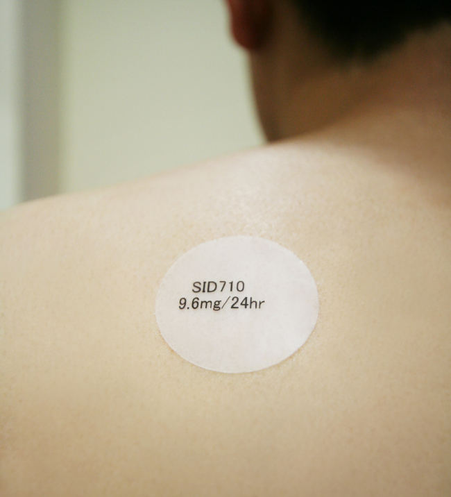 SK Chemicals' patch-type Alzheimer's medication S170 (SK Chemicals)