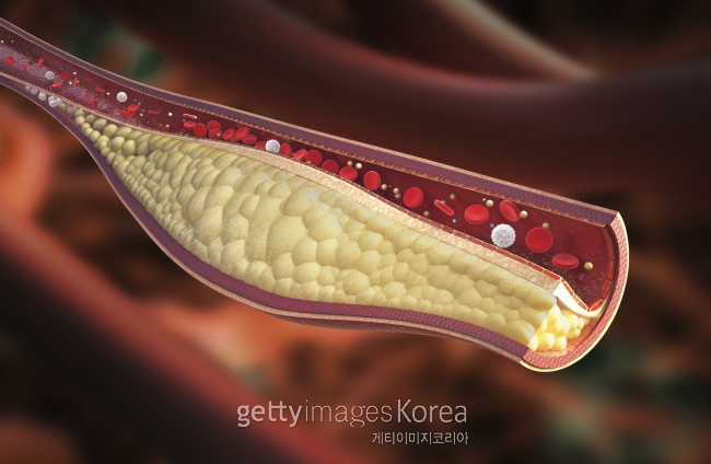 [그래픽=게티이미지뱅크]