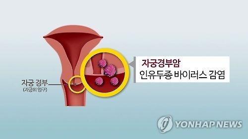 (Yonhap)
