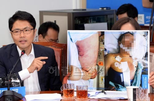 2014년 당시 국회 국방위원회 소속 김광진 위원이 선임병들로부터 폭행과 가혹행위로 사망한 윤 일병의 당시 상태를 설명하고 있다.