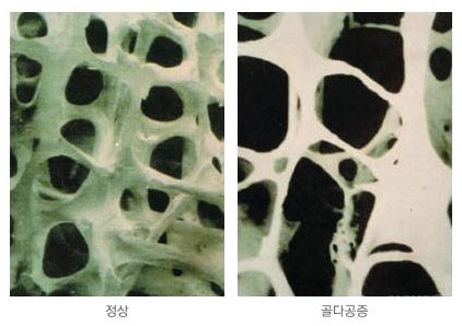 [사진출처=네이버]
[사진출처=네이버]