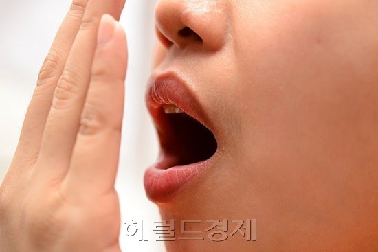 입 냄새의 원인은 잇몸 등 구강 내에 있는 경우가 대부분이다. 사진은 관련 이미지. [사진=헤럴드경제DB]