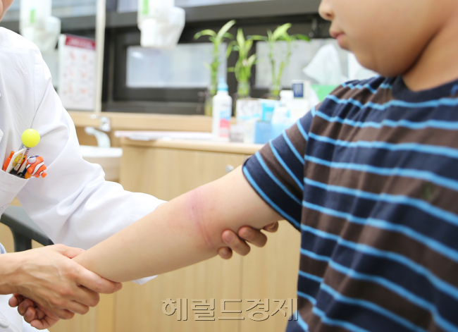 황사ㆍ미세먼지가 극심한 5월 아토피 피부염 환자가 연중 가장 많은 것으로 나타났다. [헤럴드경제DB]