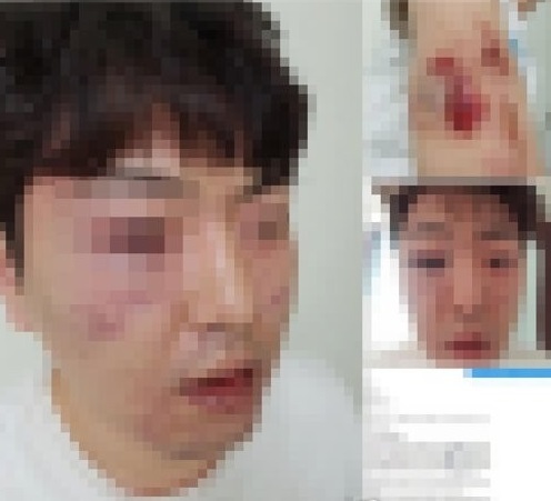 경찰 '용의자 오인' 폭행 피해자 (사진=페이스북 캡쳐/연합뉴스)