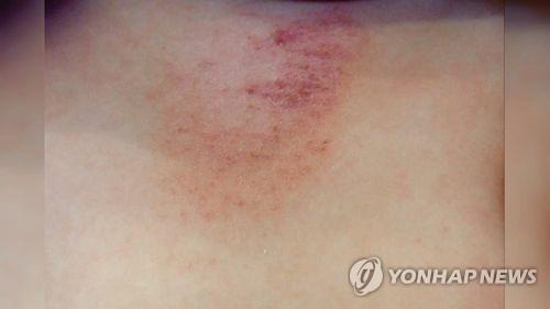 (사진=연합뉴스)