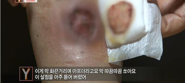[사진=SBS ‘궁금한 이야기 Y’ 캡처]