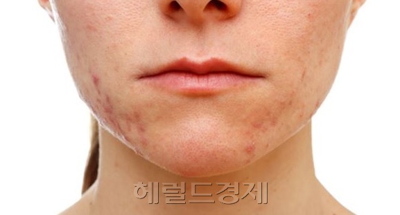 [사진=헤럴드경제DB]