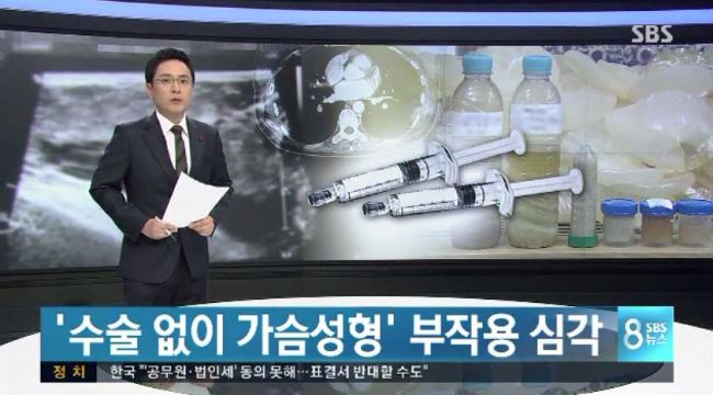 [사진=SBS 뉴스 캡처]