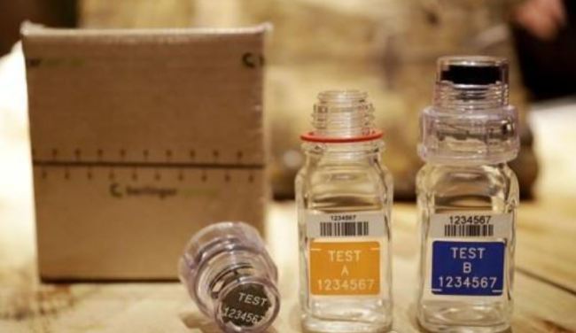Doping test instruments (AP-Yonhap)