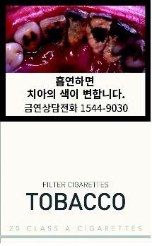 This photo provided by the Ministry of Health and Welfare shows a pictorial warning for tobacco packs on tooth discoloration, one of the side effects of smoking. (Yonhap)