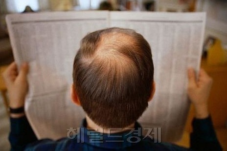 탈모는 가을에 유난히 심해진다. 남성호르몬 작용이 원인이다. 자가 치료보다 조기에 약물 치료를 받아야 더 좋은 효과를 볼 수 있다. [헤럴드경제DB]