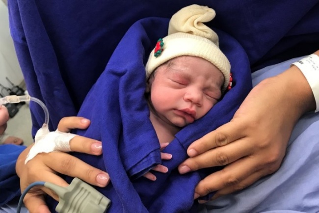 This Dec. 15, 2017 photo provided by transplant surgeon Dr. Wellington Andraus shows the baby girl born to a woman with a uterus transplanted from a deceased donor at the Hospital das Clinicas of the University of Sao Paulo School of Medicine, Sao Paulo, Brazil, on the day of her birth. Nearly a year later, mother and baby are both healthy. (AP)