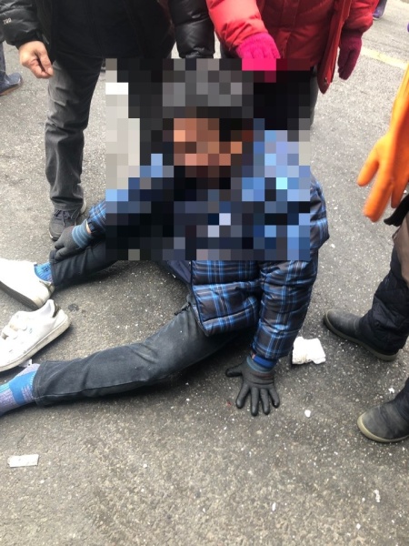 지난 11일 노량진 구시장에서 수협 직원들과 싸우다가 치아가 부러지고 입술이 터져 스물다섯바늘을 꿰맨 강모(55) 씨. 당시 현장 사진. [노량진수산시장 현대화 비대위 제공]