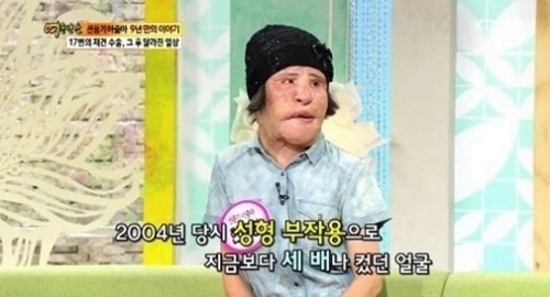(KBS 제공-연합뉴스)