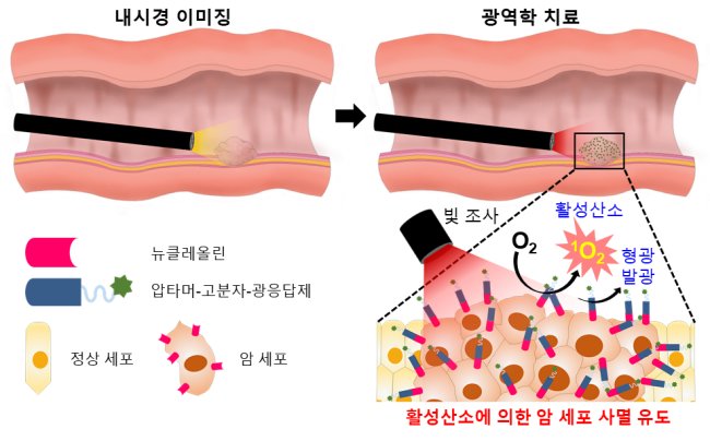 (사진) 암 표적 광역학 소재를 이용한 내시경ㆍ복강경의 진단ㆍ치료 개략도.[제공=한국연구재단]