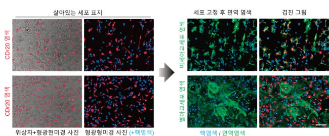 　 　(사진) 연구진은 살아있는 일차배양 뇌세포에 염색된 CDr20의 사진을 찍은 뒤, 미세아교세포에 특이적인 면역염색 결과와 대조했다. 그 결과, CDr20이 미세아교세포만을 특이적으로 염색함을 확인했다.[제공=IBS]