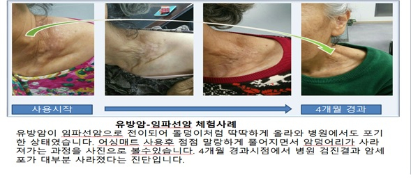 허위 과장 체험사례를 올린 모습. [서울시 제공]