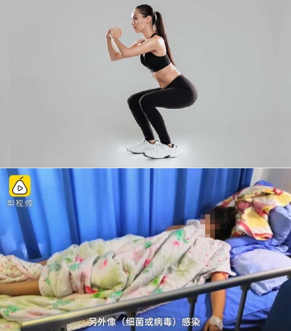 무리한 승부욕으로 인해 스쿼트운동을 하다 심각한 신장 손상으로 입원한 중국 10대 소녀들. [SBS영상 캡처]