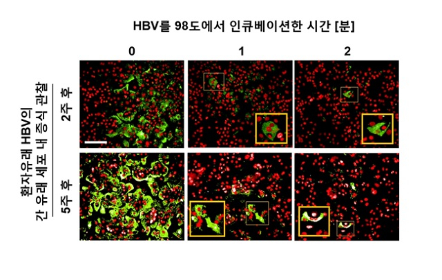 B형 간염 바이러스의 고온 열처리. 98도에서 1분 및 2 분 동안 열처리한 환자 유래 B 형 간염 바이러스(HBV)를 간 유래 세포에 감염시킨 후 2주 및 5주후에 바이러스의 증식을 면역 형광 분석을 통해 관찰했다. HBV에 감염된 세포 이미지를 확대해 노란색 박스에 나타냄.[파스퇴르연구소 제공]