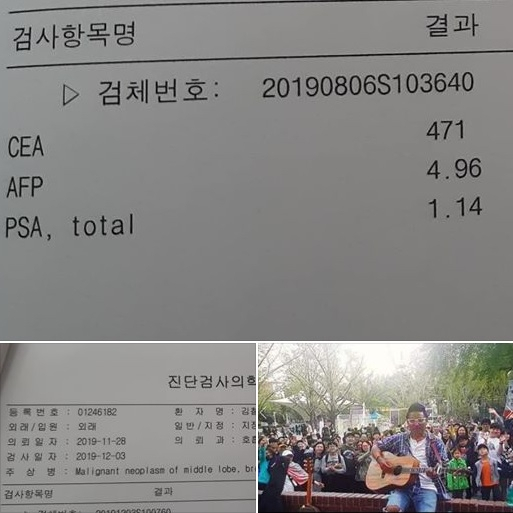 폐암 4기 판정을 받은 가수 김철민이 자신이 예고한 대로 검진 결과를 6일 SNS에 공개했다. 개구충제인 펜벤다졸을 복용 중인 것으로 알려진 김철민의 건강 상태는 피검사, 암수치가 많이 줄었으며 간수치와 콩팥 기능 등이 정상으로 나왔다며 희망적인 결과를 전했다. [김철민 페이스북 캡처]
