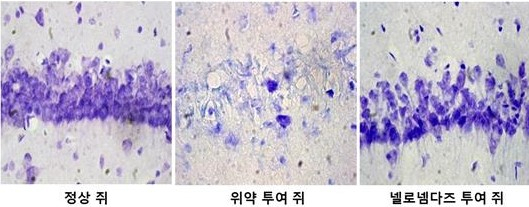 ‘넬로넴다즈’ 뇌 신경세포 사멸 방지 시험