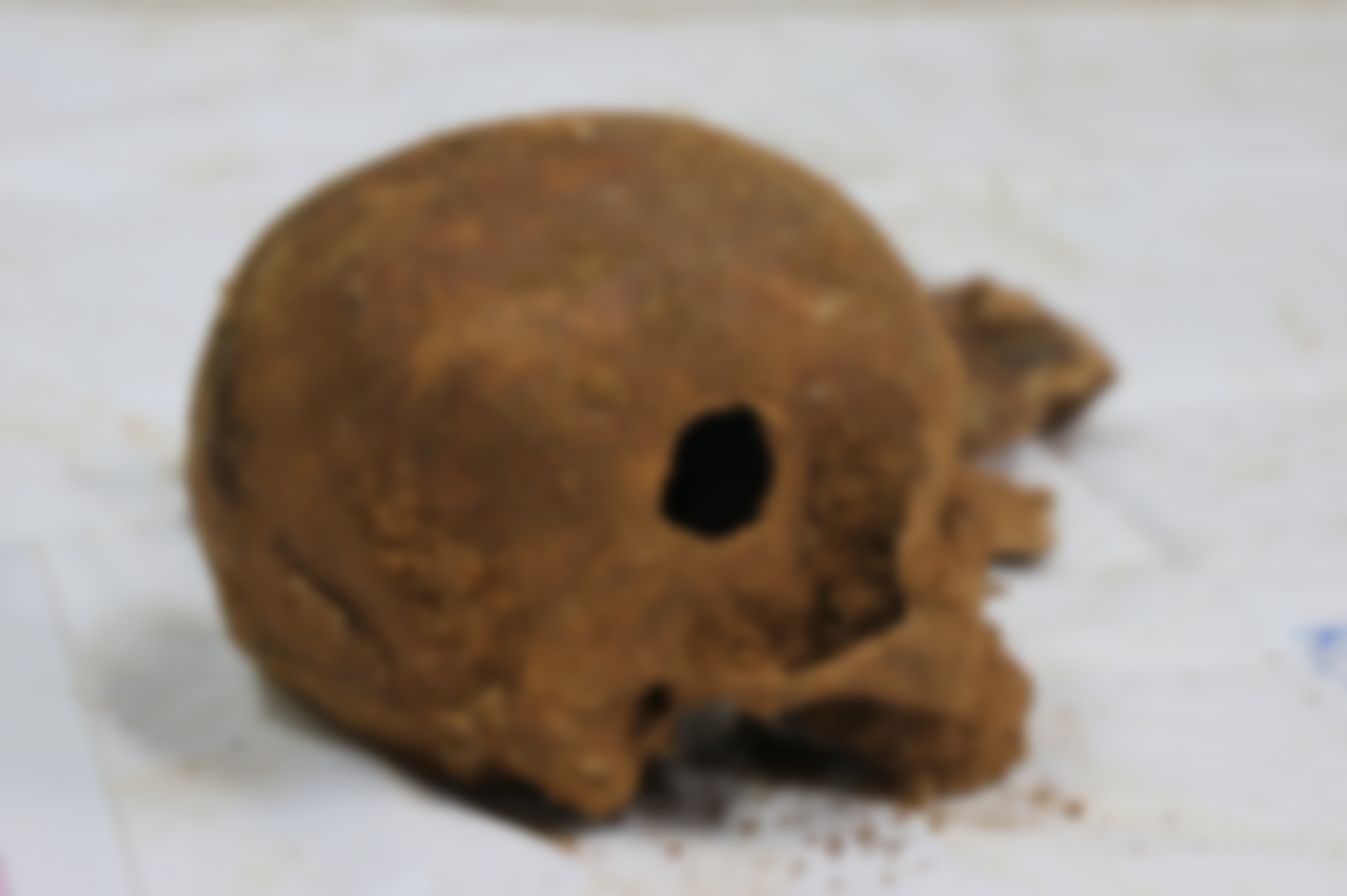 The photo shows one of two skulls with holes of unknown causes that were found among remains. (Yonhap)