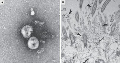 배양된 신종 코로나바이러스를 광학현미경으로 관찰한 모습[NEJM 논문 발췌] 연합 제공